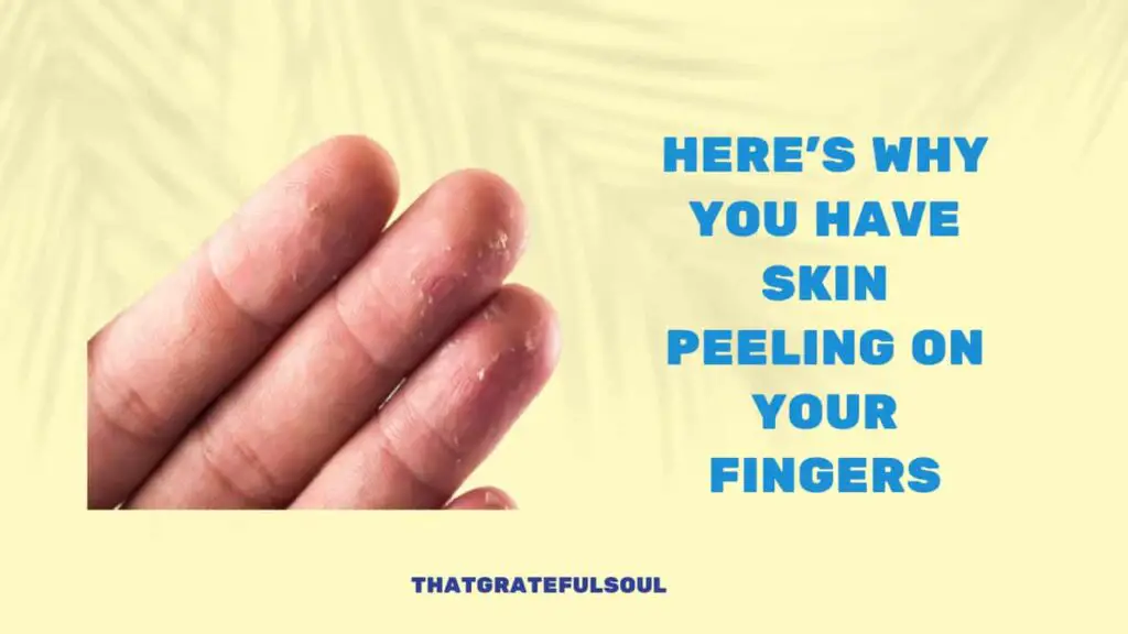 why you have skin peeling on your fingers