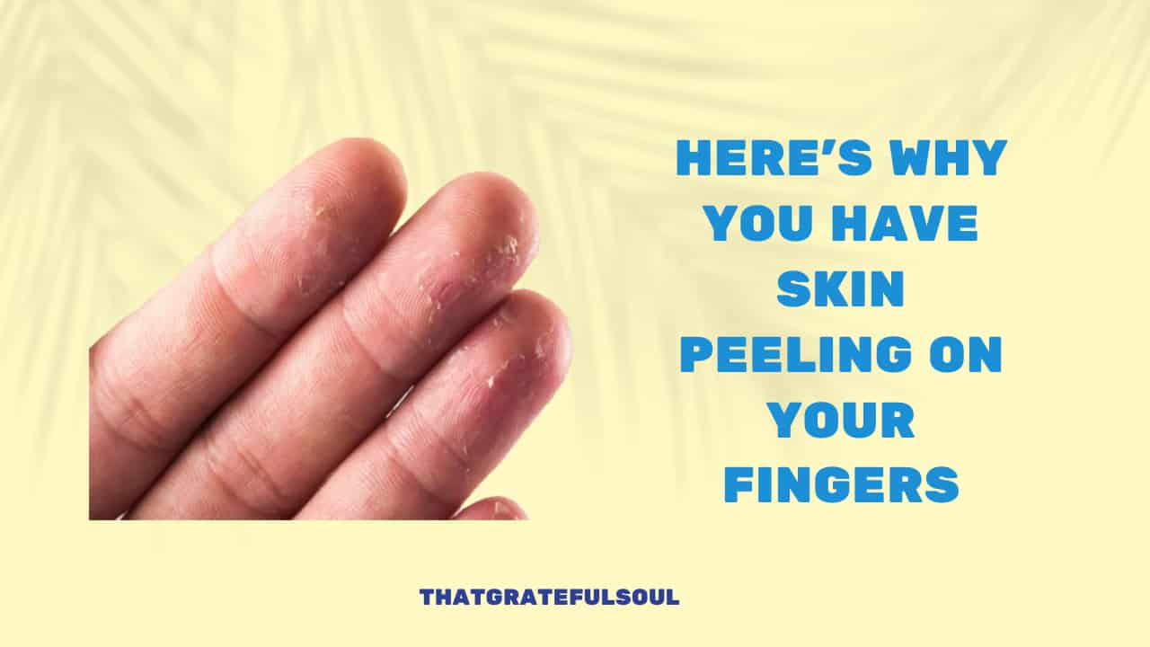 Here’s Why You Have Skin Peeling on Your Fingers That Grateful Soul